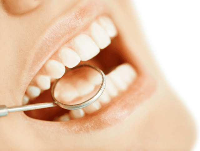 Professionelle Mundhygiene