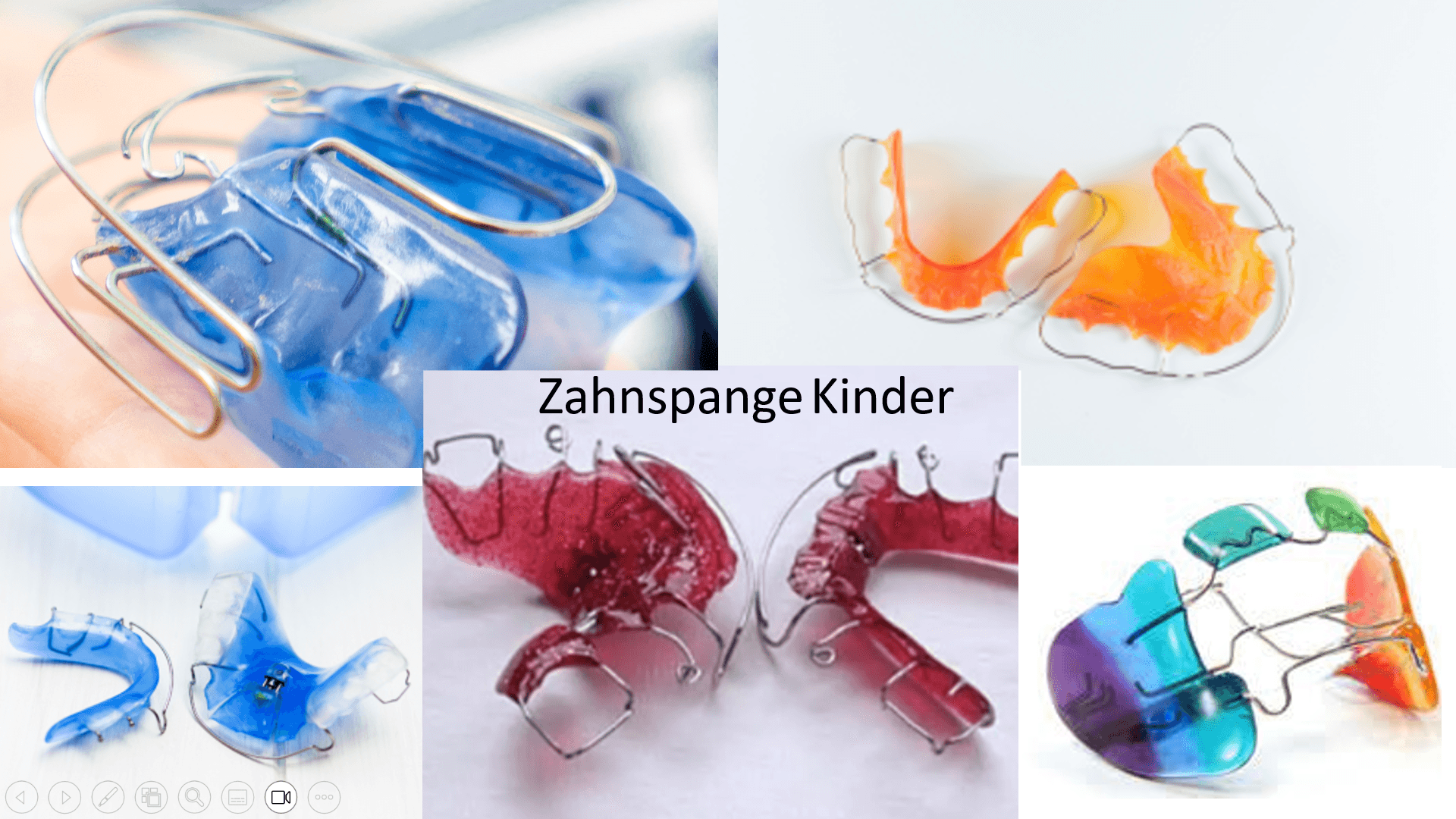 Metall-Brackets an den Frontzähnen