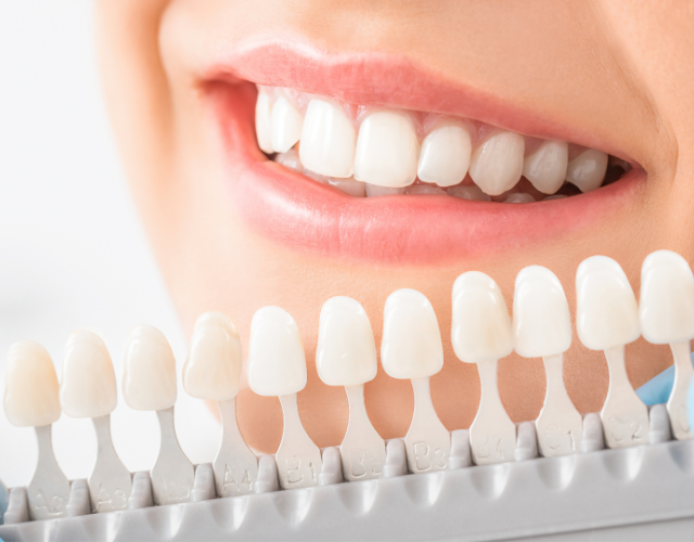 Whitening