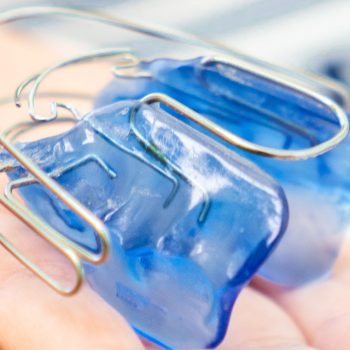Removable myofunctional therapy appliance in blue acrylic with metal components
